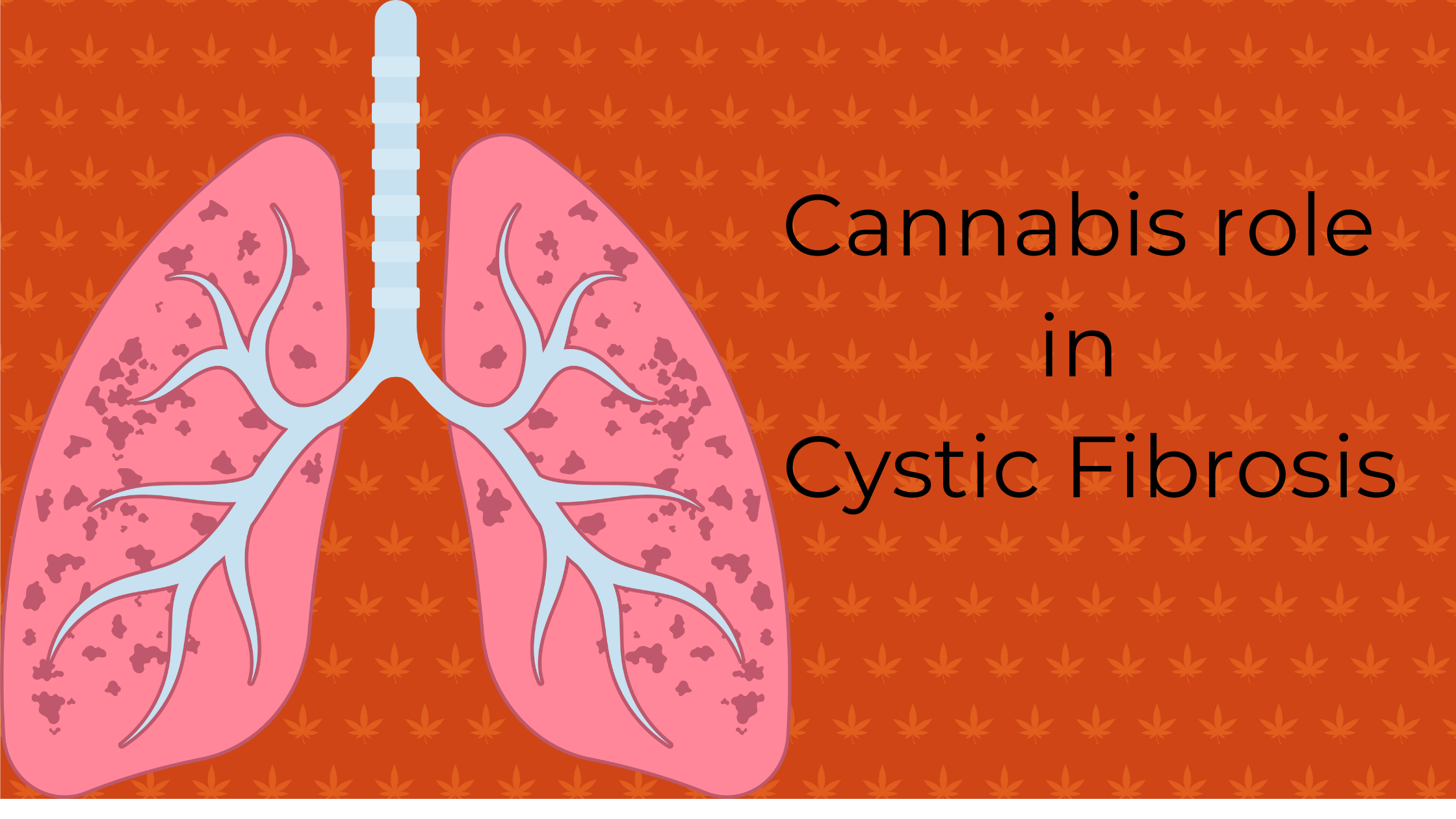 Exploring the Potential of Cannabis Strains in the Treatment of Cystic Fibrosis.