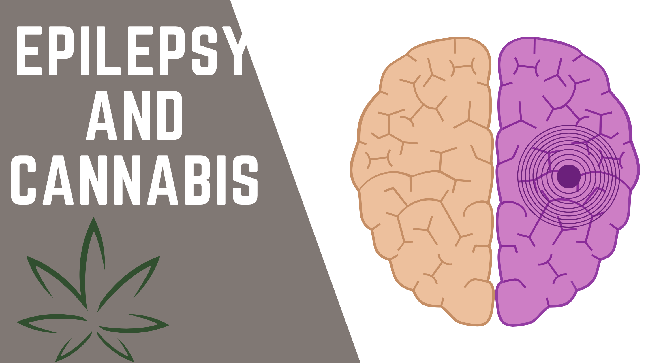 An Evidence-Based Perspective in Managing Epilepsy with Medical Cannabis.