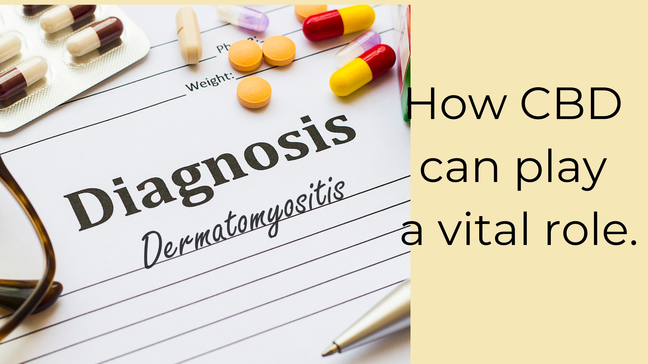 Harnessing the Potential of Cannabis Strains in Dermatomyositis Treatment.
