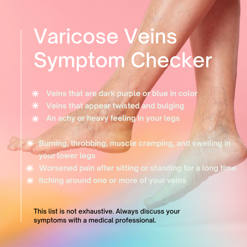 Image showing legs with varicose veins, detailing symptoms like swelling, discoloration, and pain.